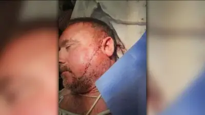 Man gets over 50 stitches after being slashed by stranger outside Tufts Medical Center